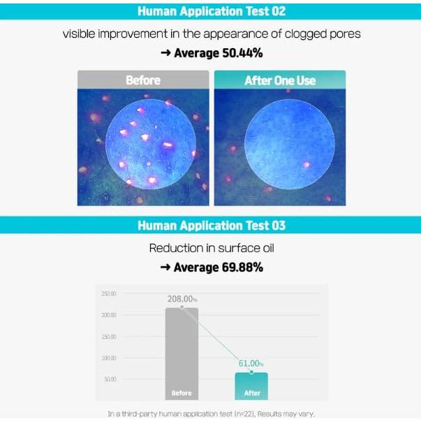 Limpiador Facial Aceite Centella Poreless 150ml - GreenCos