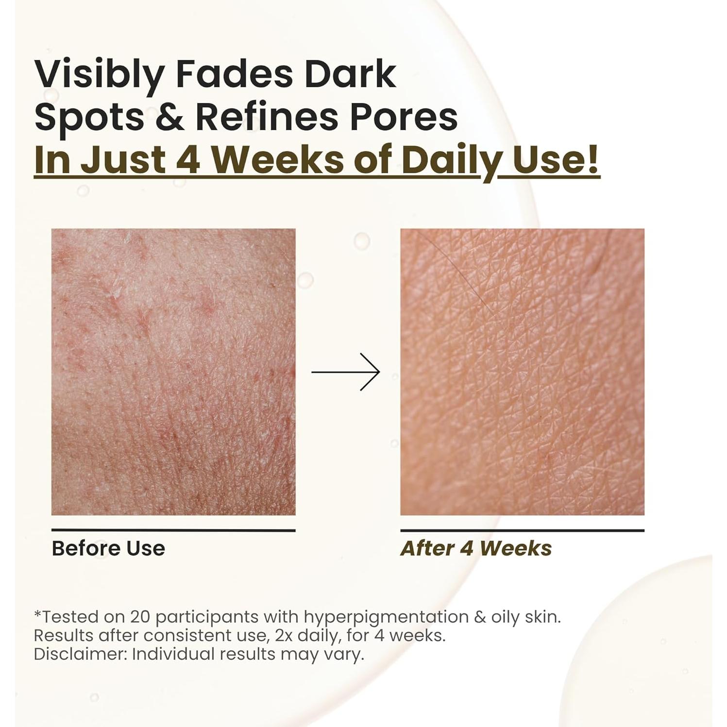 Aceite Facial Brillante Choglow 68g - Alternativa Natural al Retinol