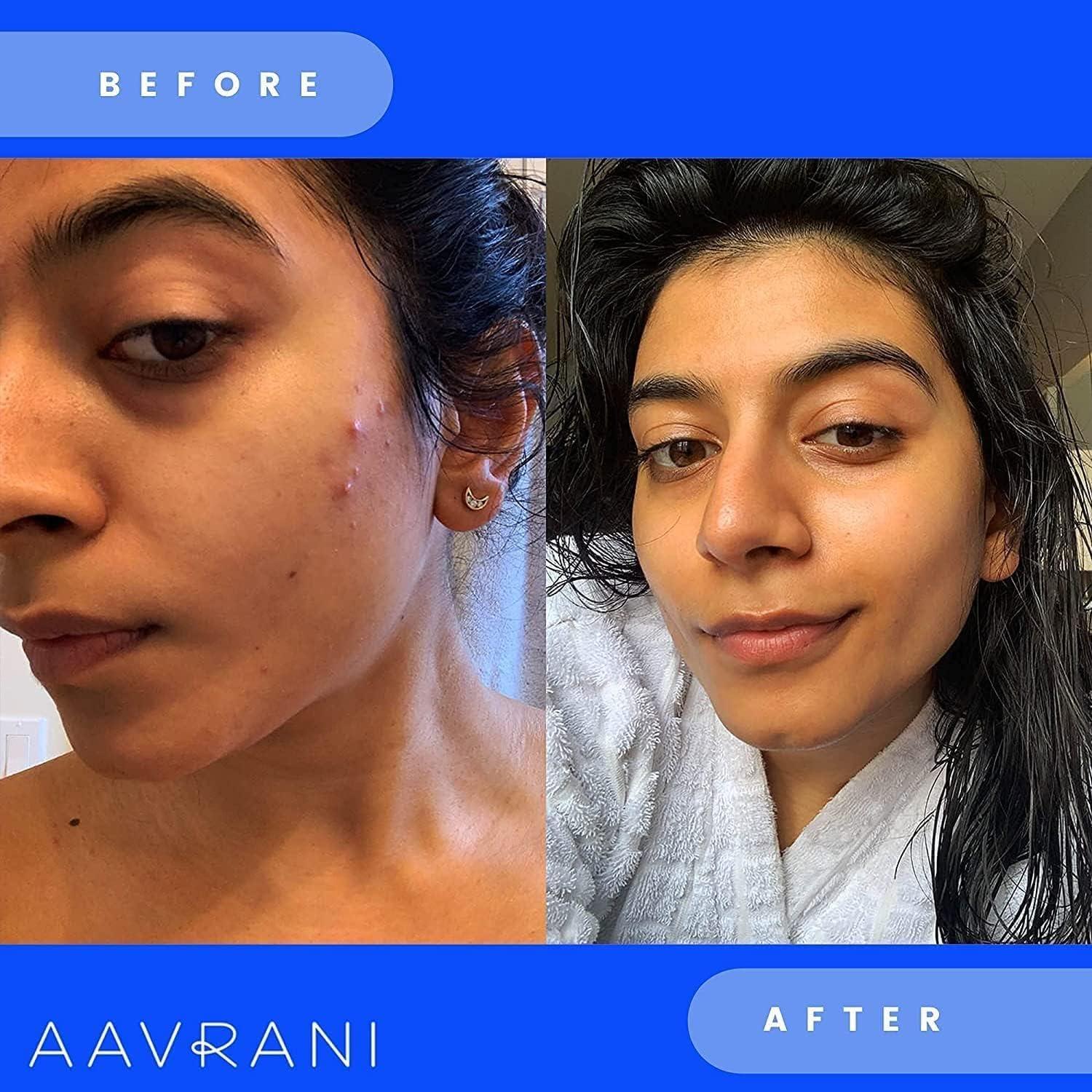 Mascarilla Facial Exfoliante AAVRANI 50.5g - Cúrcuma y Aloe