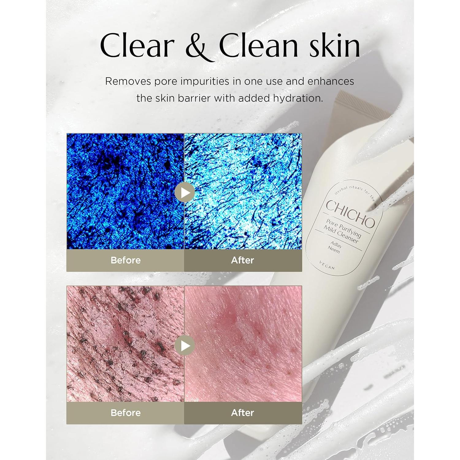 Limpiador Facial Suave Coreano CHICHO 120ml - Piel Sensible