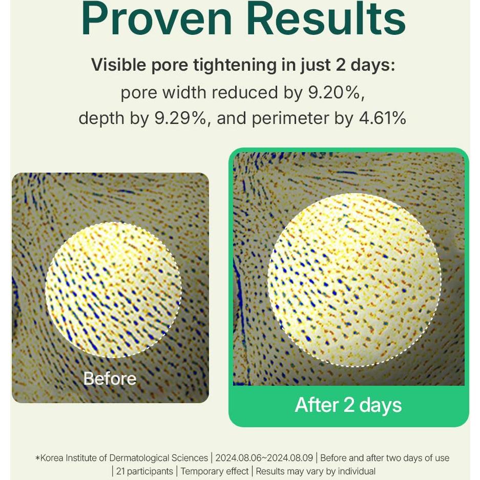 Centellian 24 Madeca Powder Tea Tree AC 6 g - Control Aceite y Poros