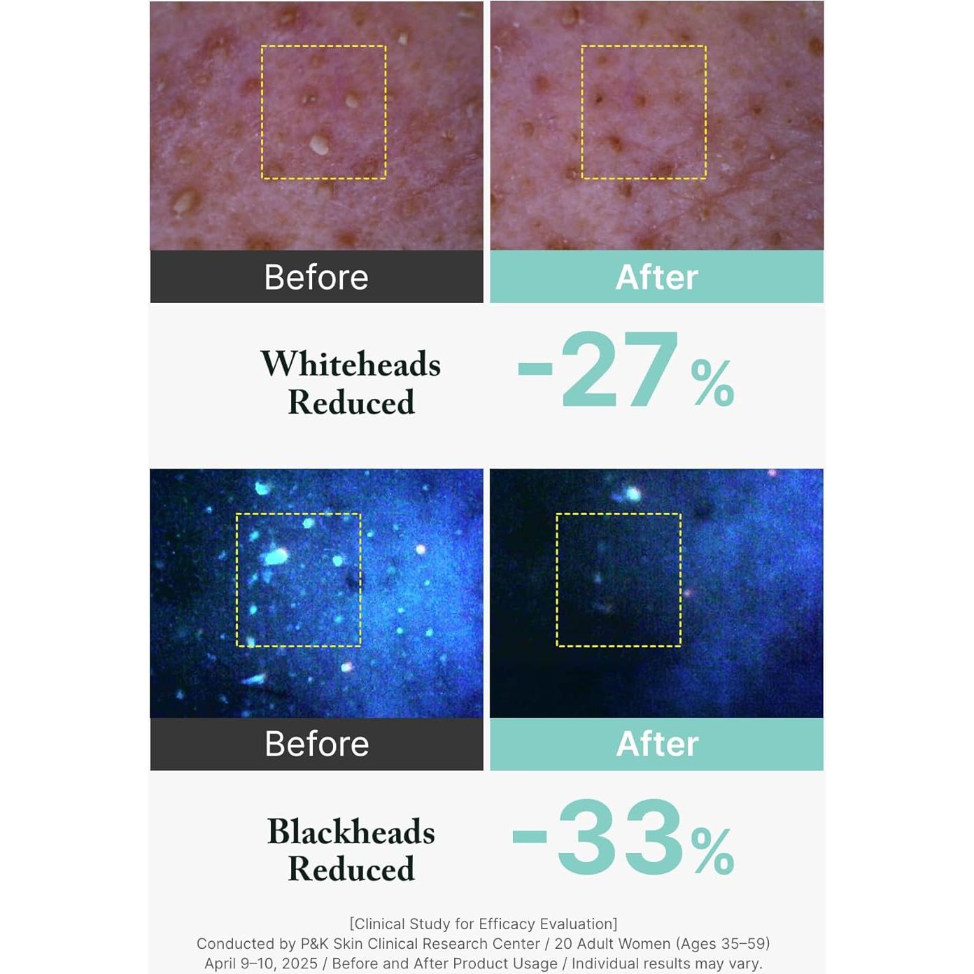 Aromatica Mascarilla y Limpiador Facial 2 en 1 148 ml - Árbol de Té