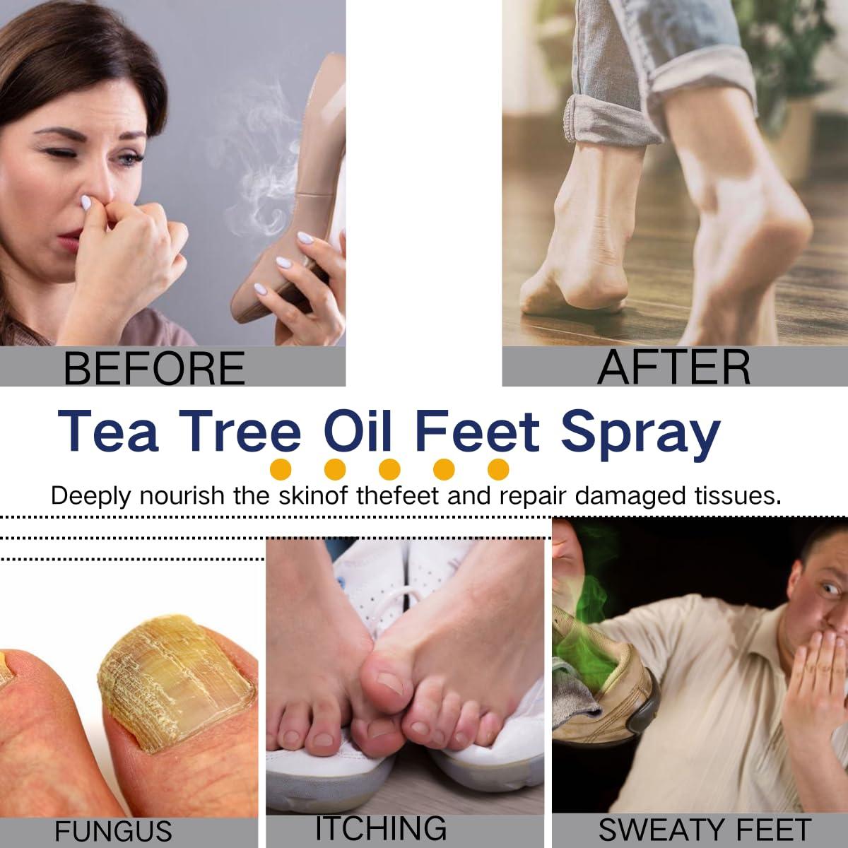 Spray Hidratante para Pies Yancaid con Aceite de Árbol de Té 2PCS