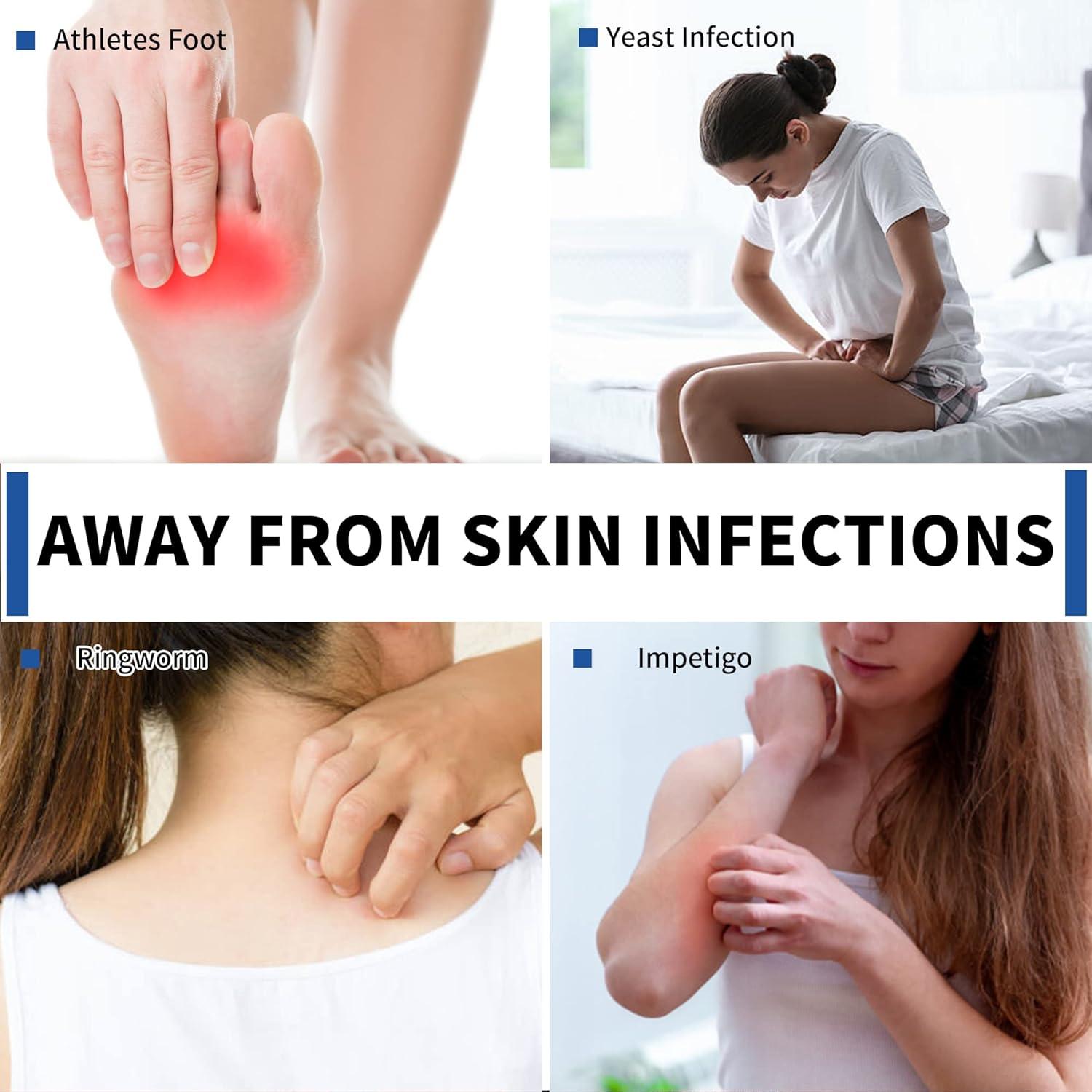 Jabón Antifúngico Battleskin 170g - Aceite de Árbol de Té