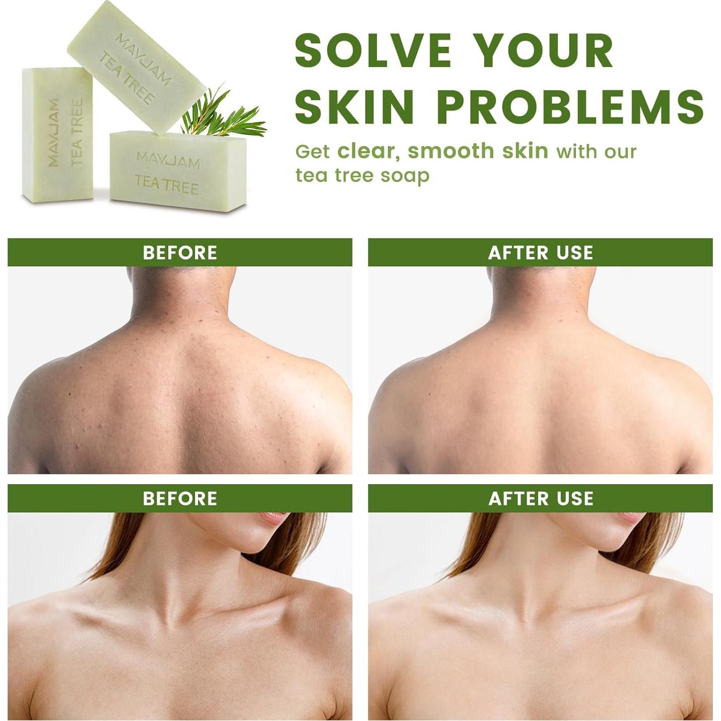 Jabón en Barra MAYJAM de Aceite de Árbol de Té 99.22g