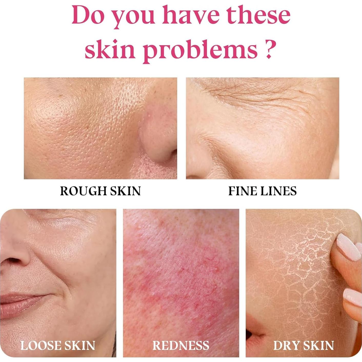 Set de Cuidado Facial Sakura - Kit de Viaje 6 Piezas