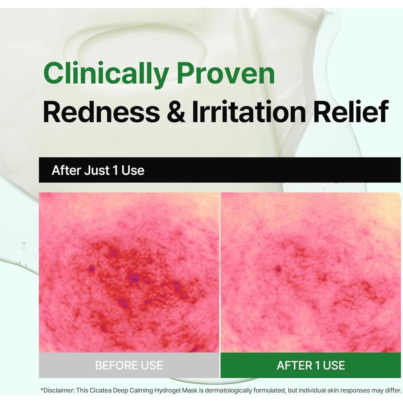 Mascarilla Hidrogel Calmante JINCOSTECH 4x35g Centella Asiática