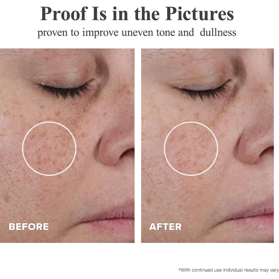 Cápsulas Suero Corrector de Manchas HKH Triple Vitamina C 40g