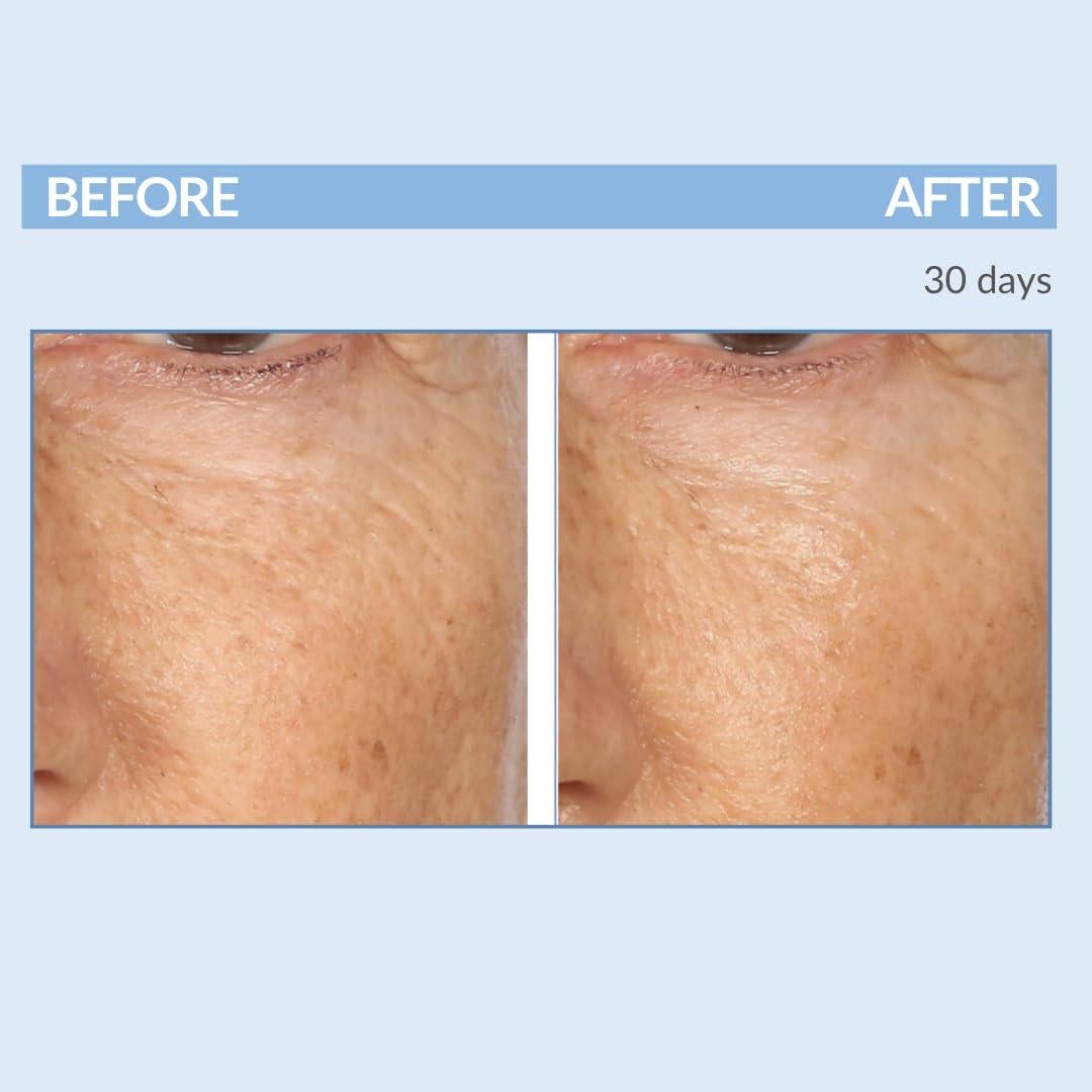 Set Cuidado Piel Anti-Envejecimiento Retinol Celmark 3 Piezas