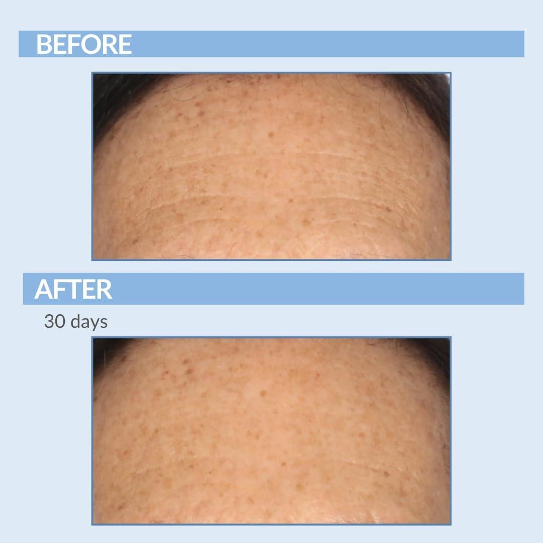 Set Cuidado Piel Anti-Envejecimiento Retinol Celmark 3 Piezas