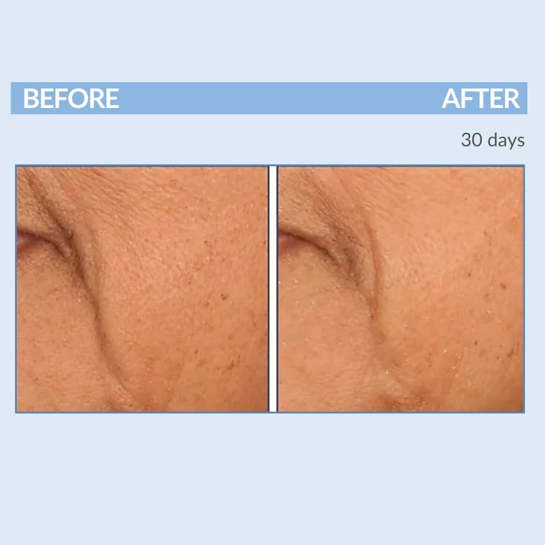 Conjunto Antienvejecimiento Serious Skincare - Suero A Force XR y Crema A