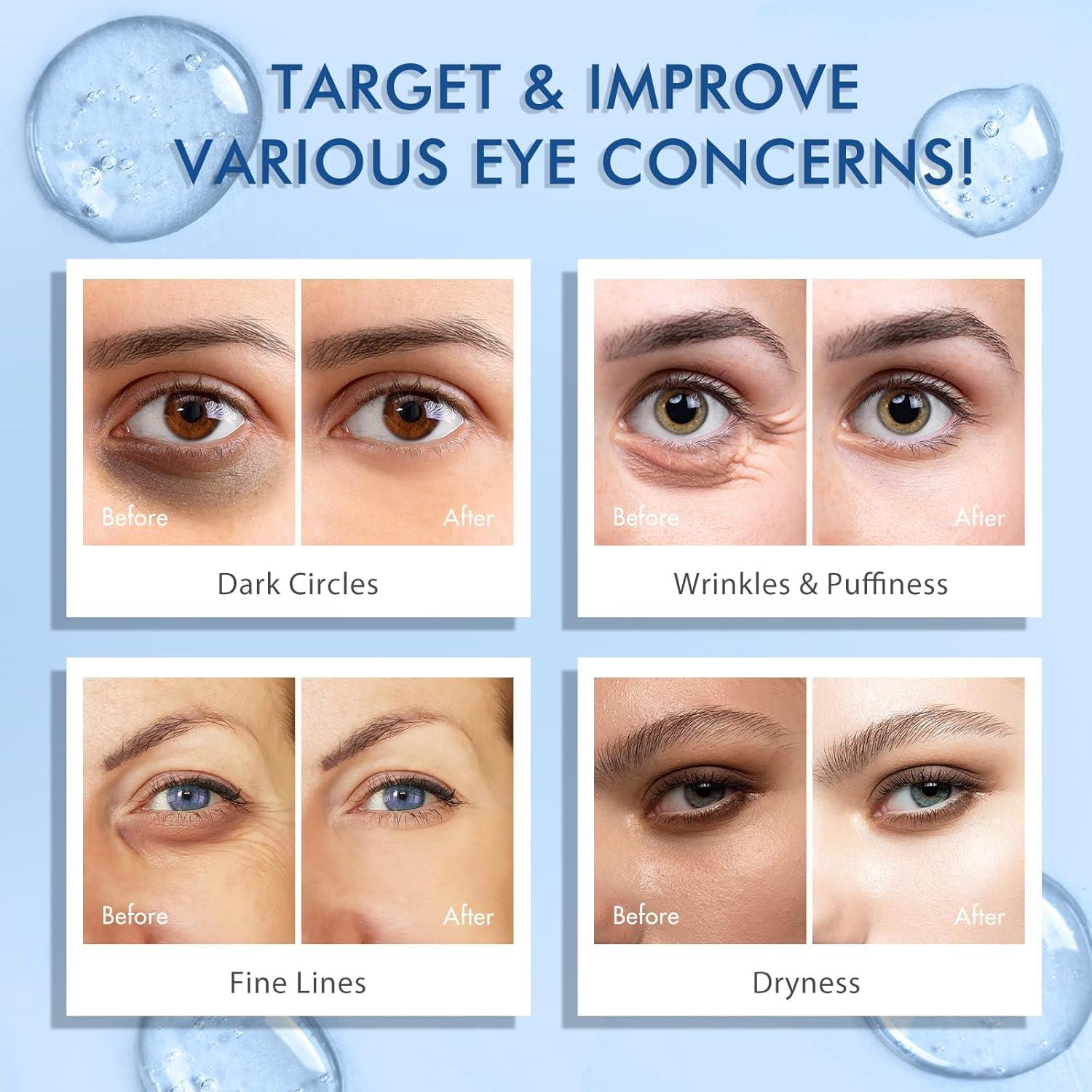 Suero para Ojos Akeeronn 14.79 ml con 5% Cafeína y Bola Masaje