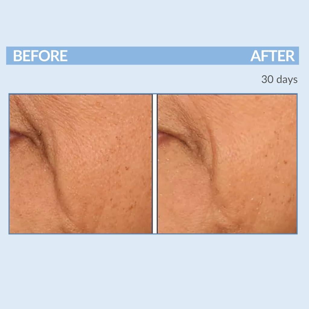 Suero Concentrado de Retinol Serious Skincare 60 ml - Antienvejecimiento