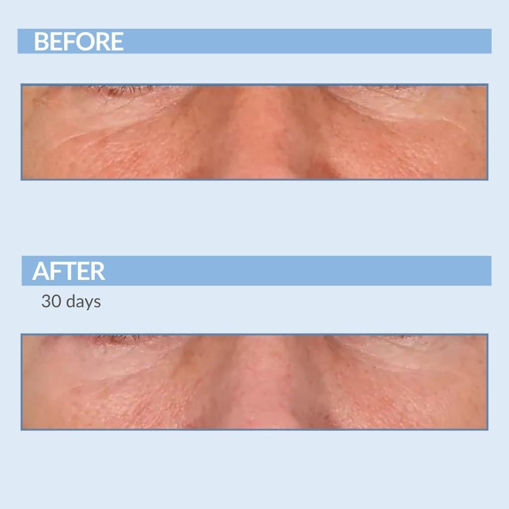 Suero Concentrado de Retinol Serious Skincare 60 ml - Antienvejecimiento