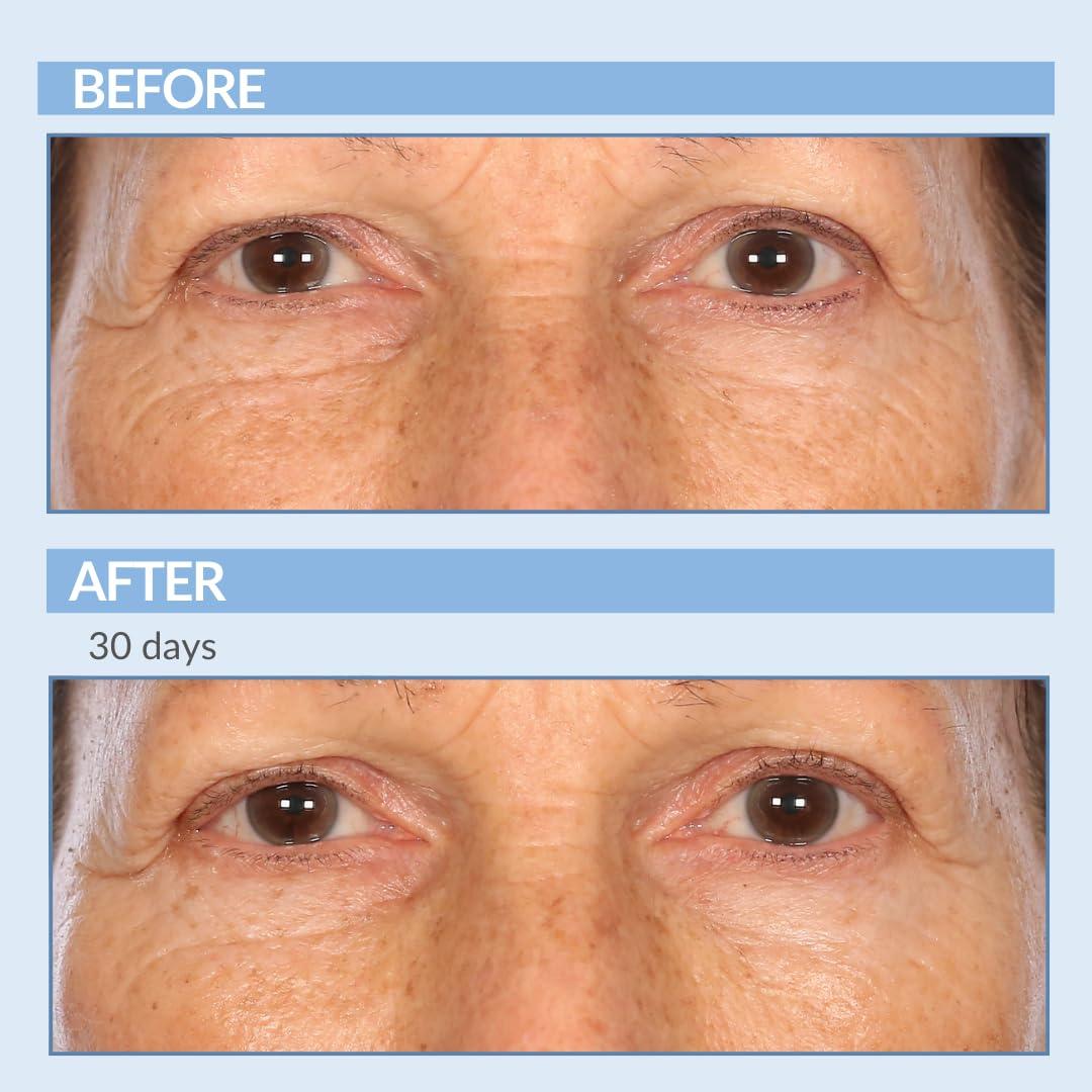 Suero Concentrado de Retinol Fuerza A - 28.35 g - Cuidado Piel