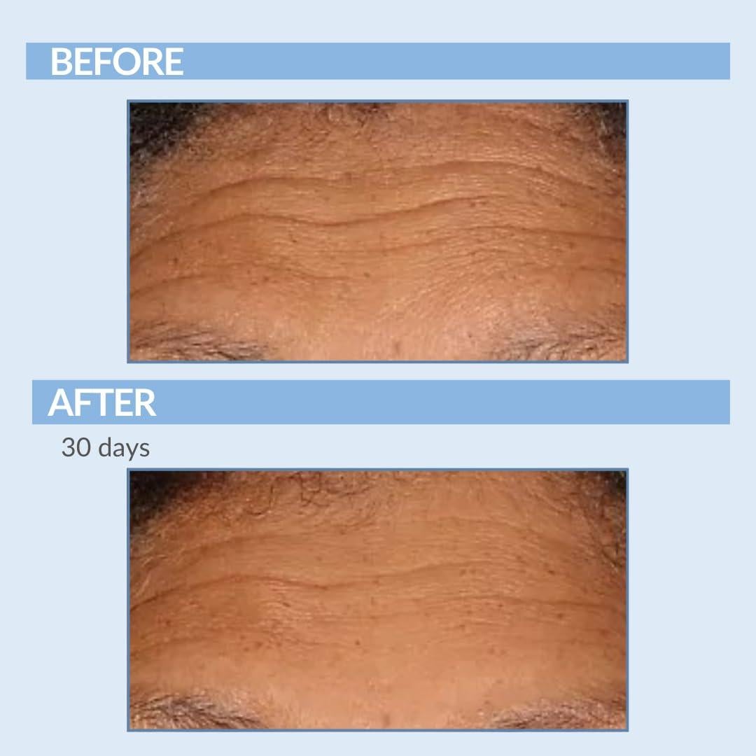 Suero Concentrado de Retinol Fuerza A - 28.35 g - Cuidado Piel