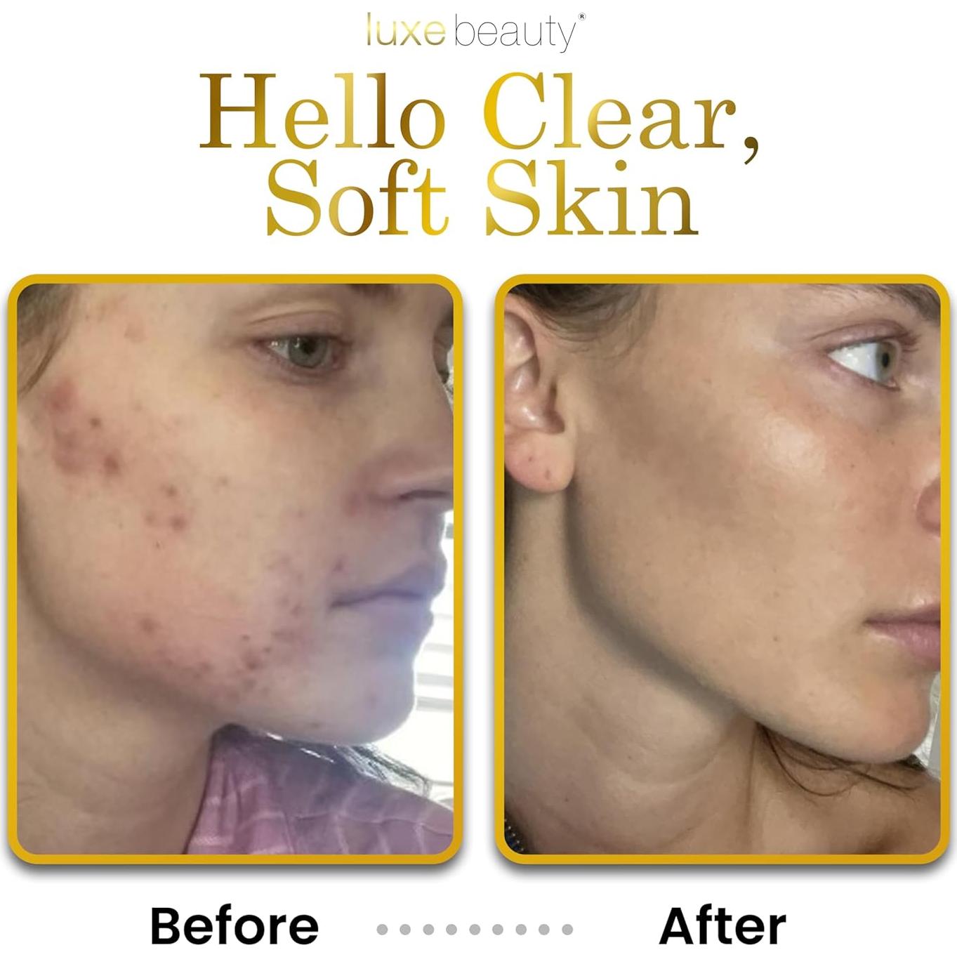 Hidratante Facial No Graso Luxe Beauty 250 ml - Ácido Hialurónico Pomelo