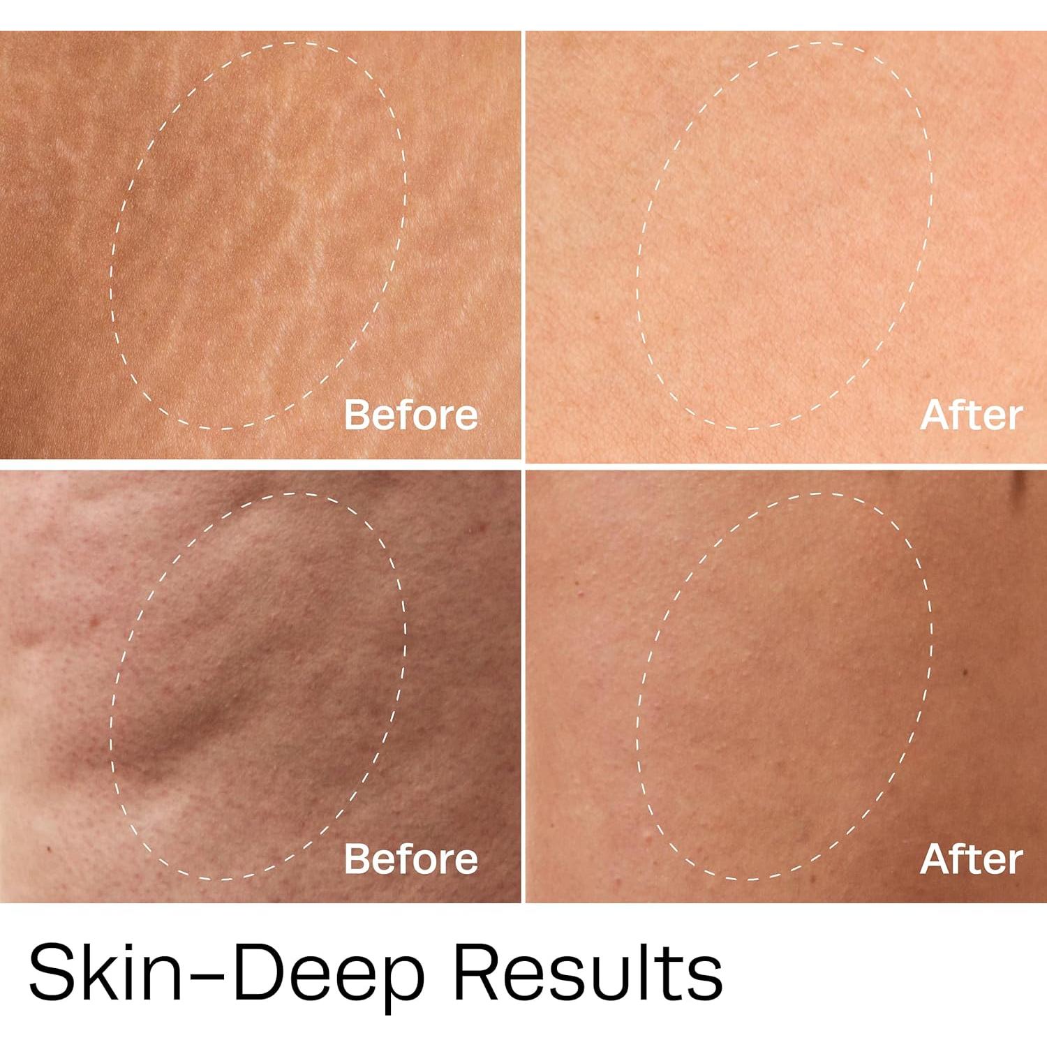 Aceite Corporal de Vitamina C Hot Vita 89 ml - Hidratante y Reafirmante