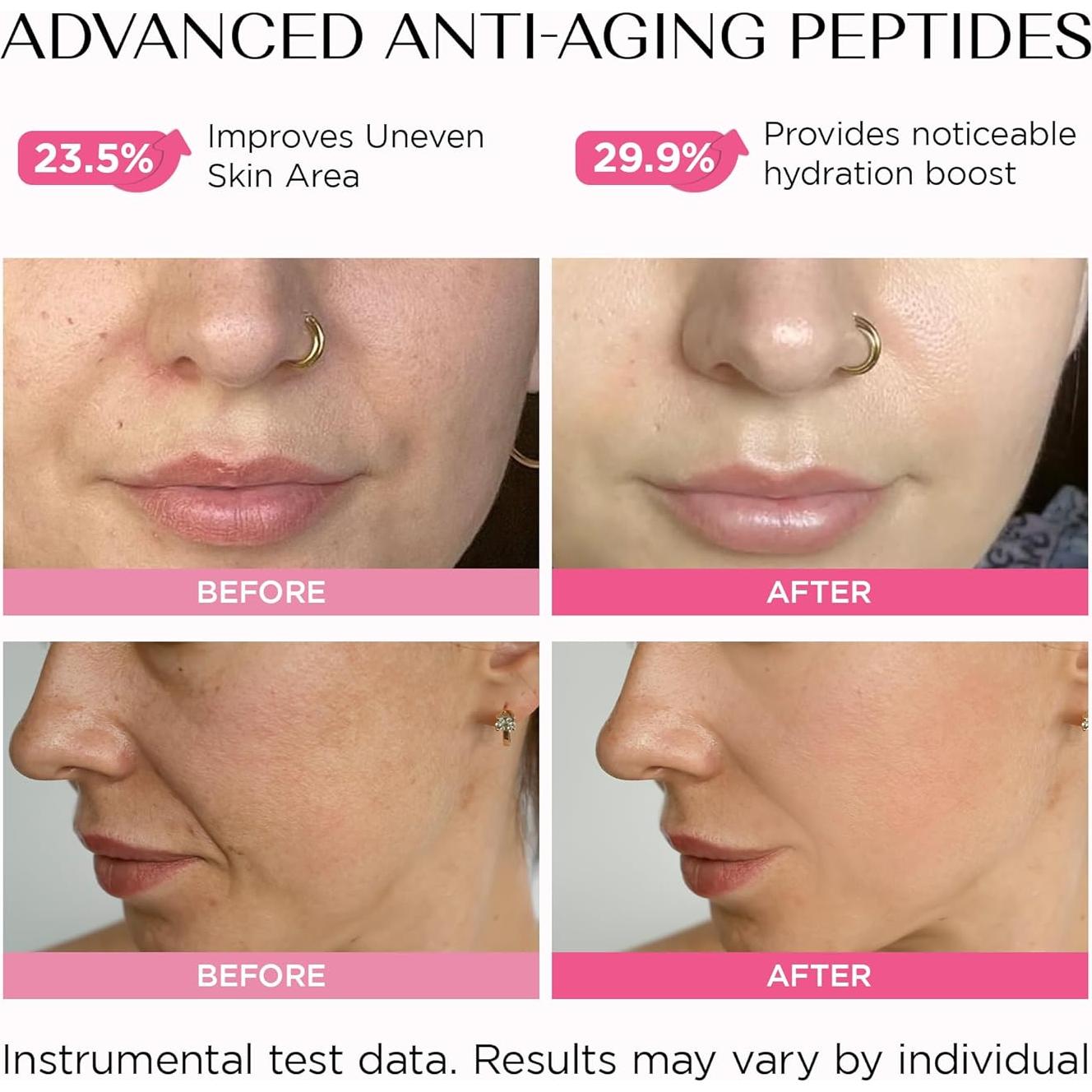 Suero Antienvejecimiento IKIMI con PDRN y Ácido Hialurónico 29.57 ml