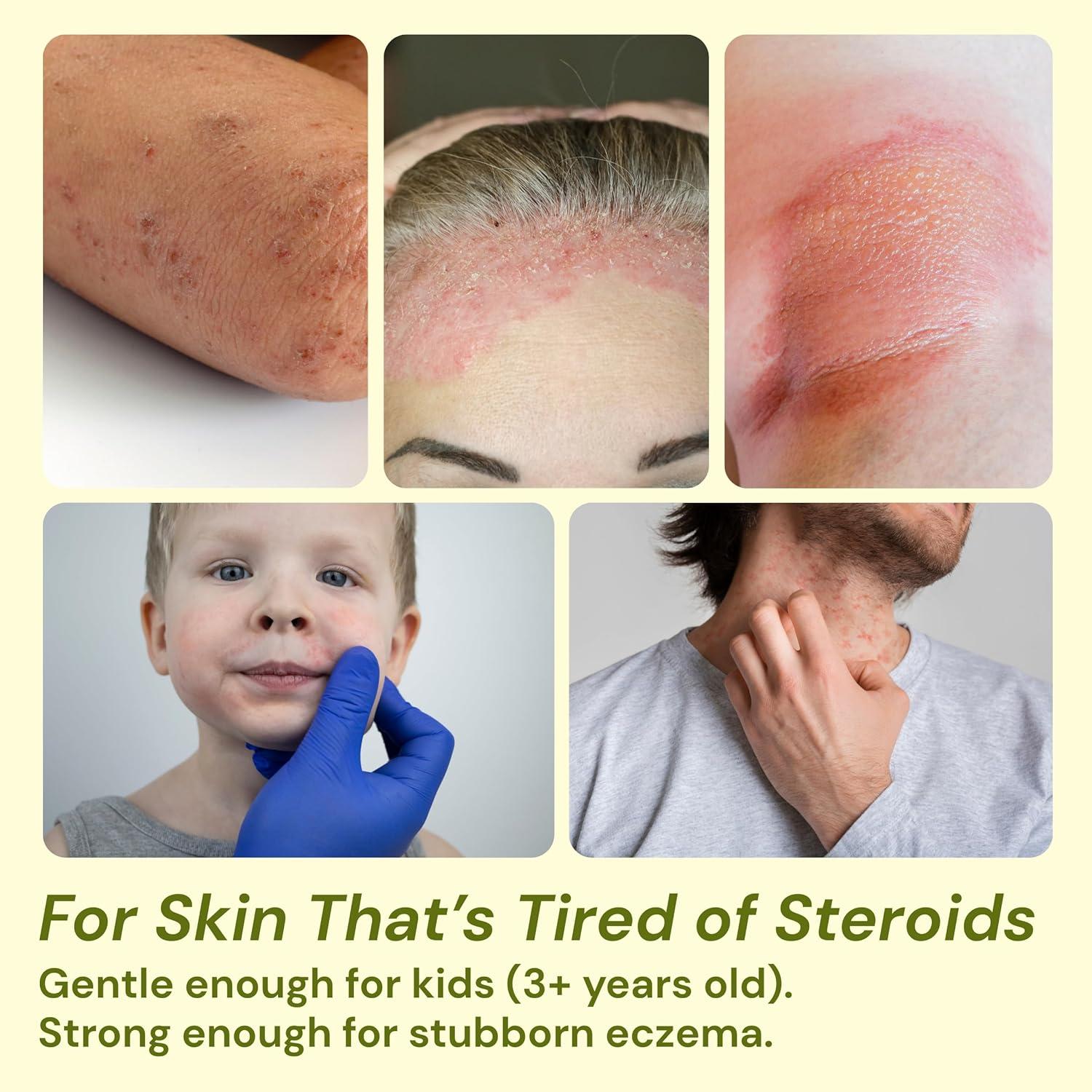 Crema Alivio Eczema Artemisa y Menta 30g Natural Orgánica