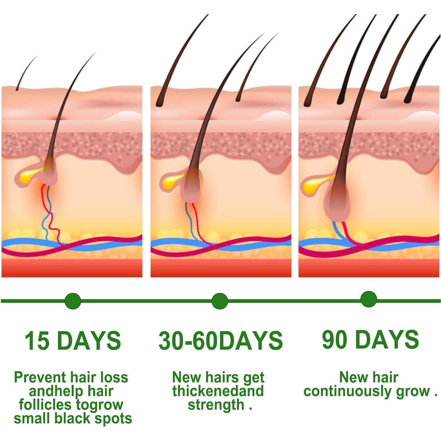Aceite Esencial de Romero 100ml - GOSNLDOW, 100% Puro Orgánico