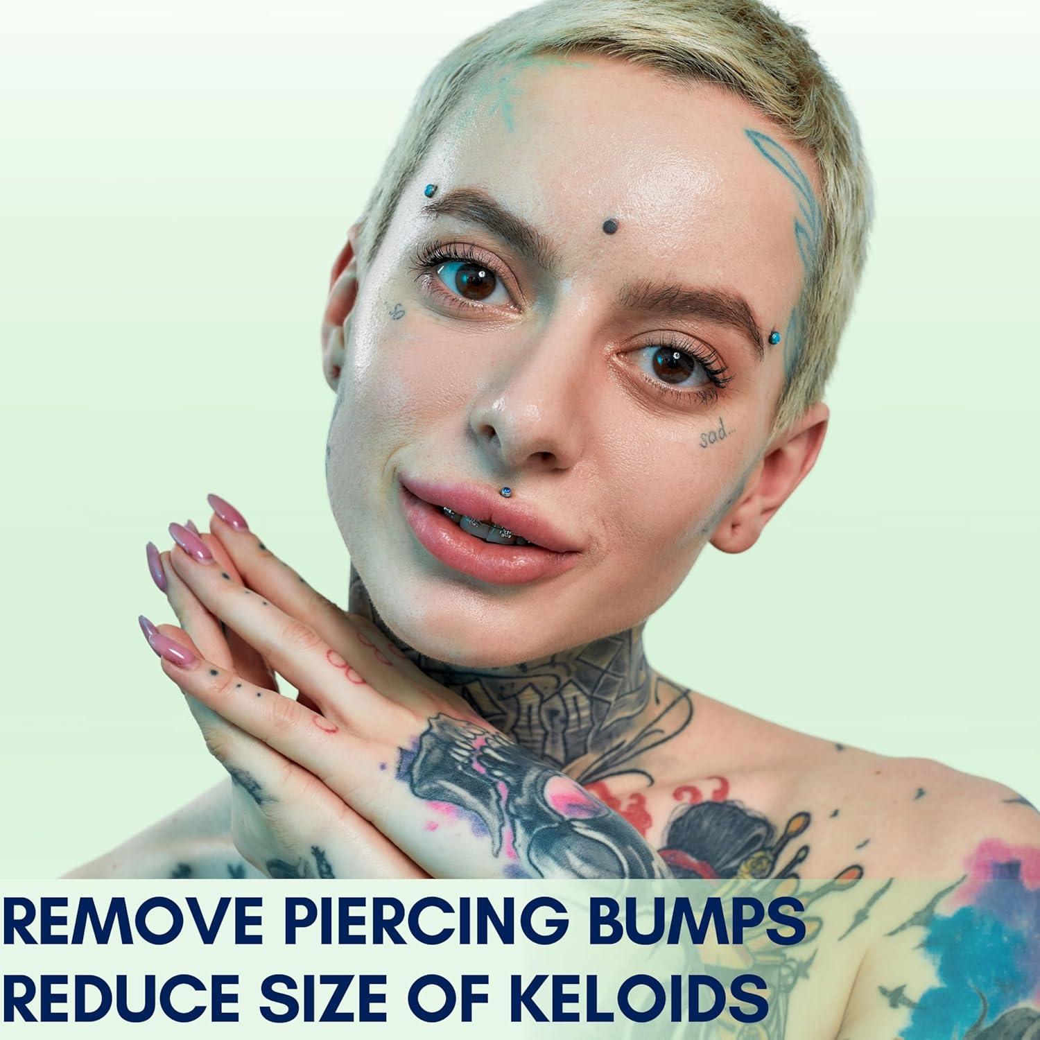 BodyJ4You Tratamiento Natural para Bultos Keloides 10ml