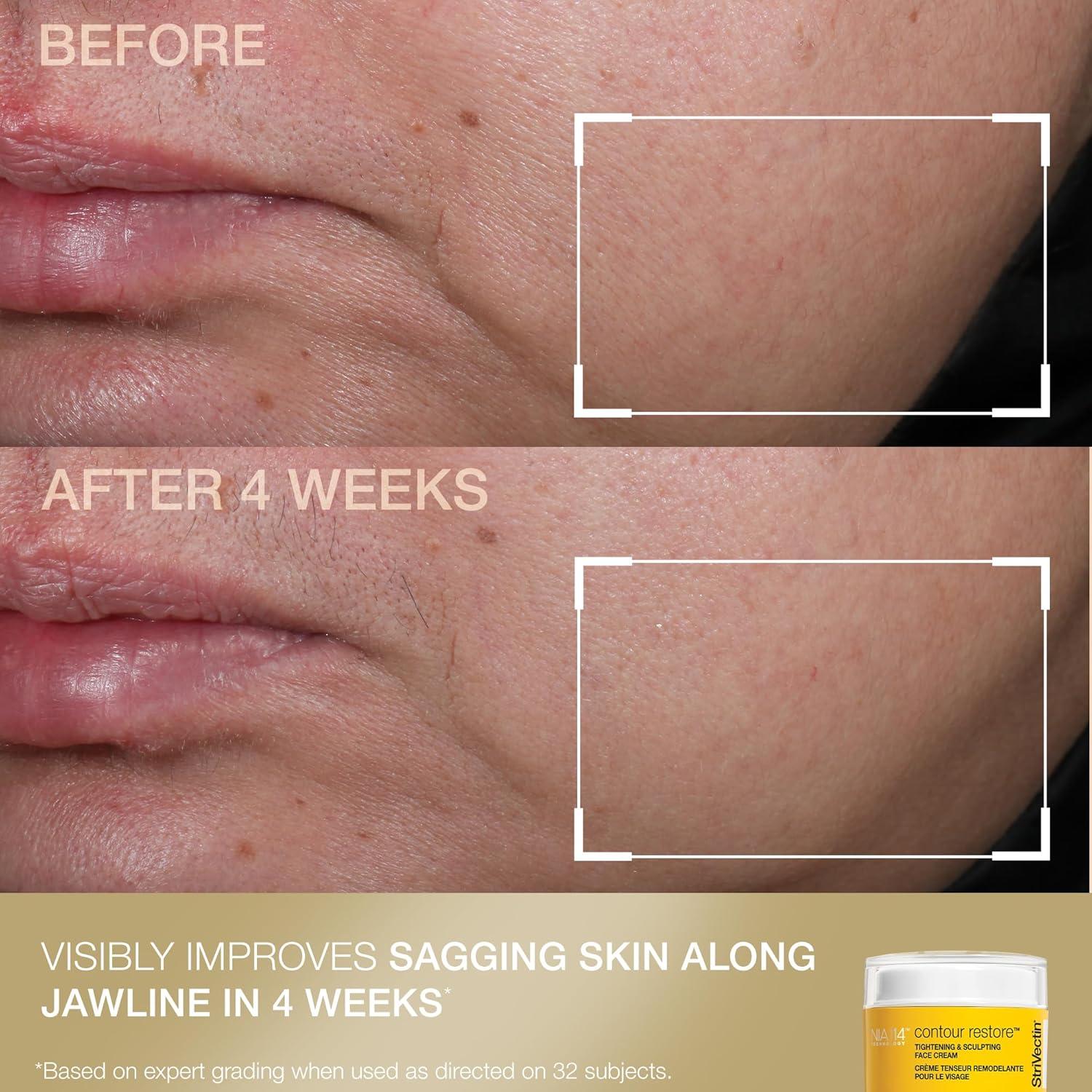 Set de Cuidado de la Piel Antienvejecimiento StriVectin 2 Piezas