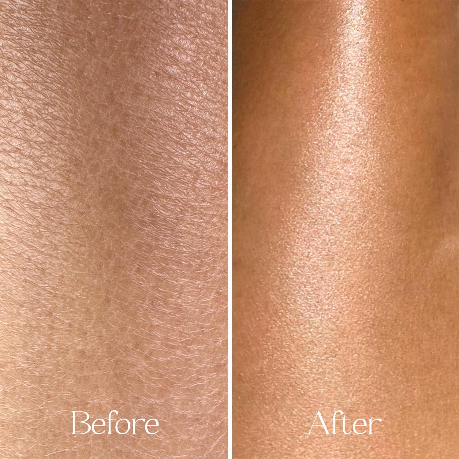 Aceite Corporal Seco Everist Spritz 181 ml con Vitaminas C y E