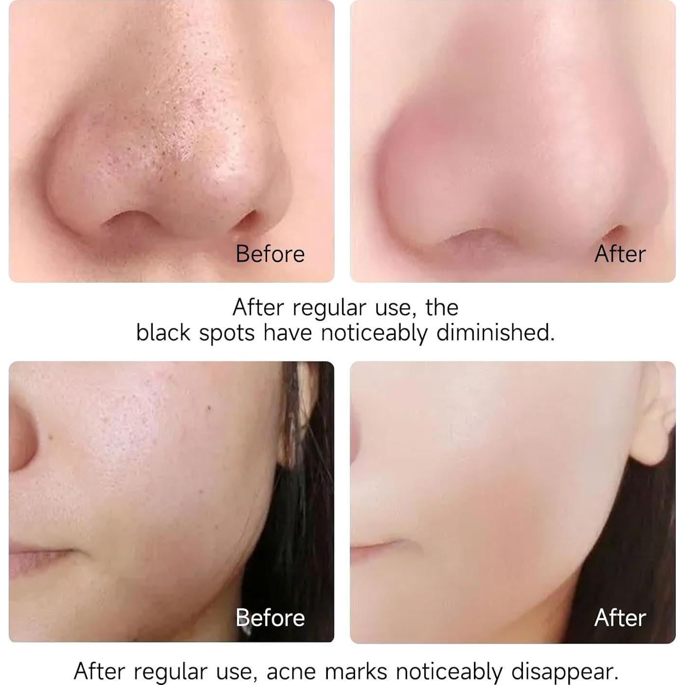 Mascarilla Burbujeante PasaRose 90g - Limpieza Facial Profunda