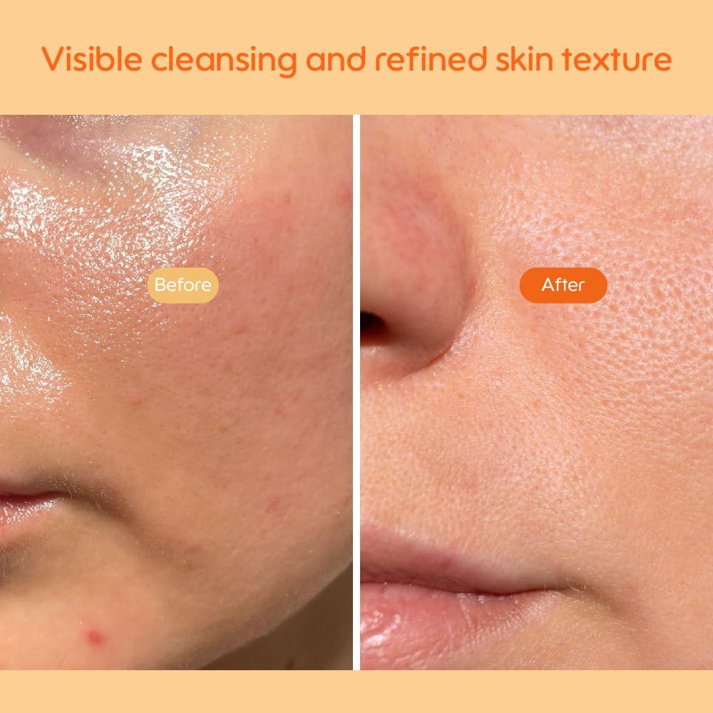 Limpiador Enzimático Refinador Kiero 50g - Facial Vegano con Papaya