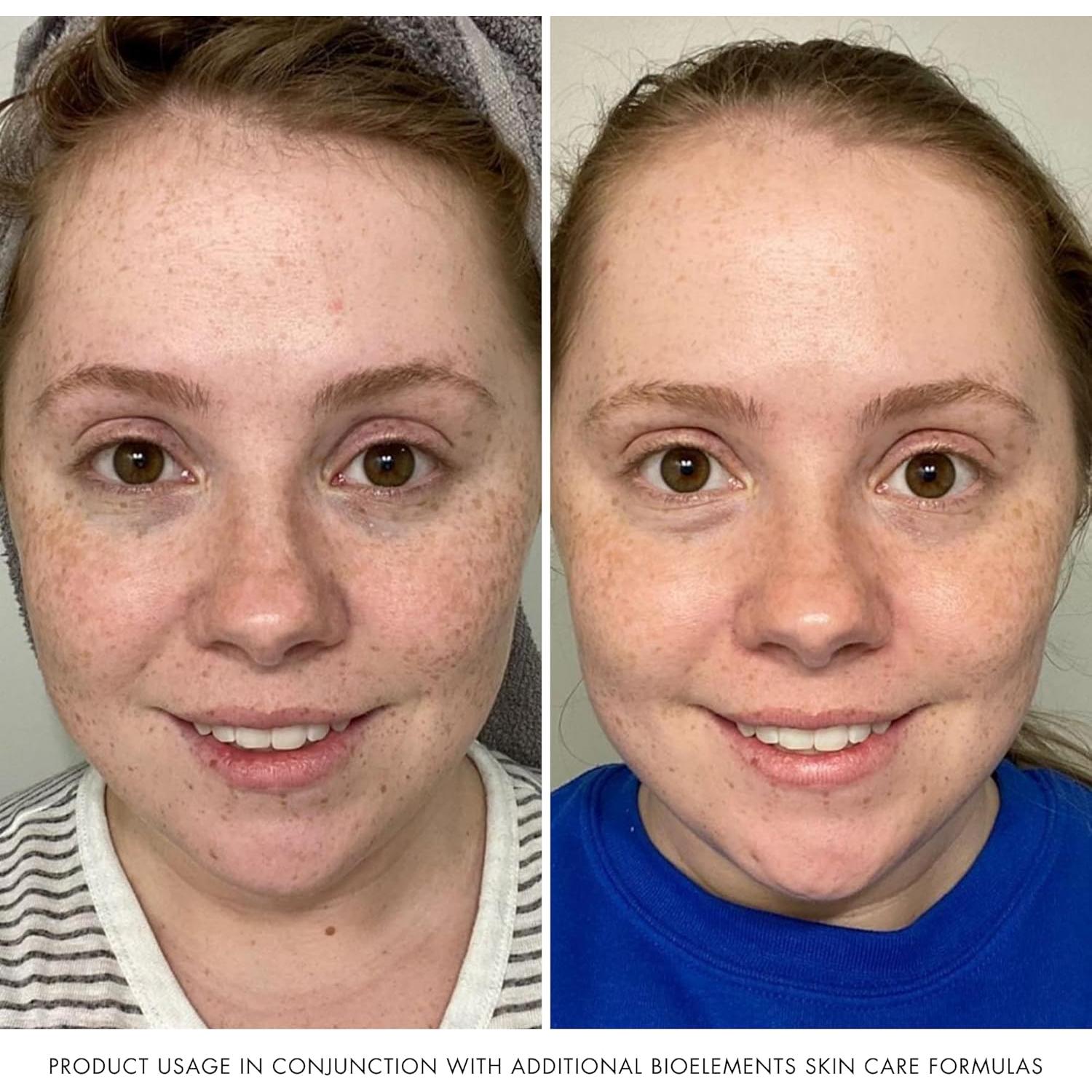 Tónico Facial Hidratante Bioelements Equalizer 177 ml Vegano