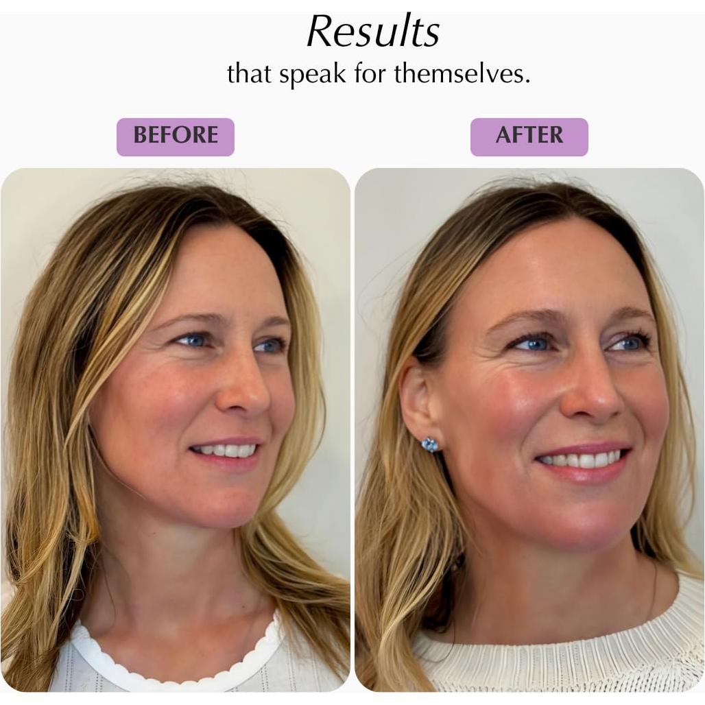 Set de Cuidado Facial Shimmer Chef 170g | Hidratación y Brillo