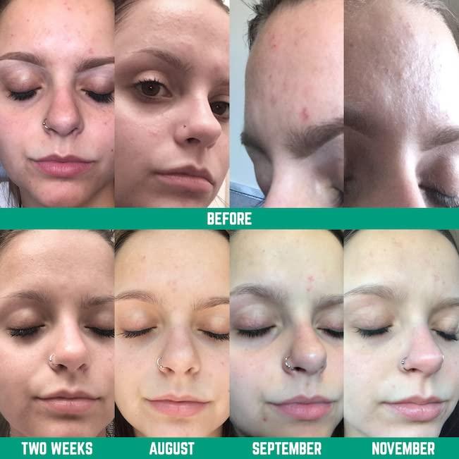 Limpiador Facial Equilibrante Ninja 155.9 g - Sin Sulfatos ni Parabenos