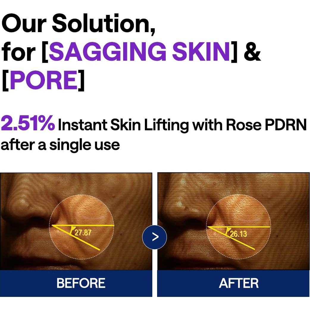 Suero Facial Lifting Mediheal PDRN 40 ml con Escualano