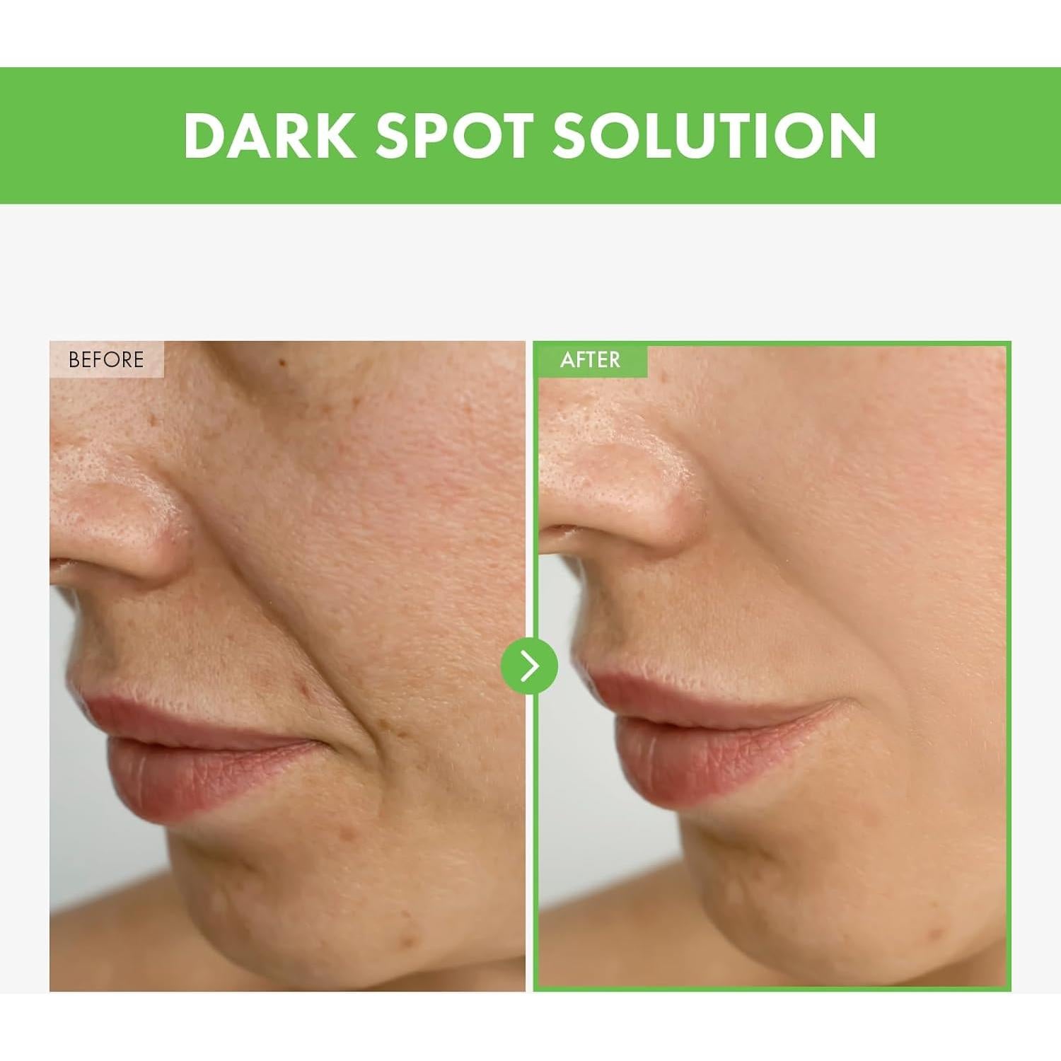 Crema para Imperfecciones TOSOWOONG Kakadu Plum 50g