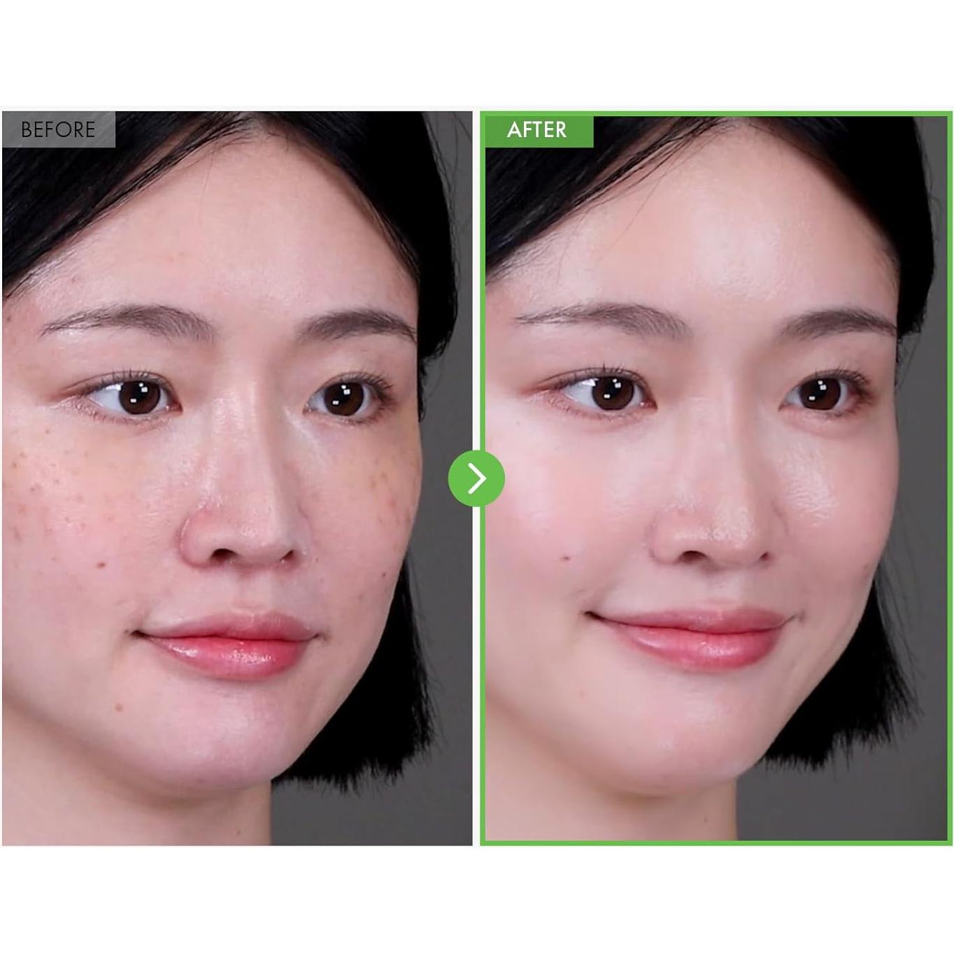 Crema para Imperfecciones TOSOWOONG Kakadu Plum 50g