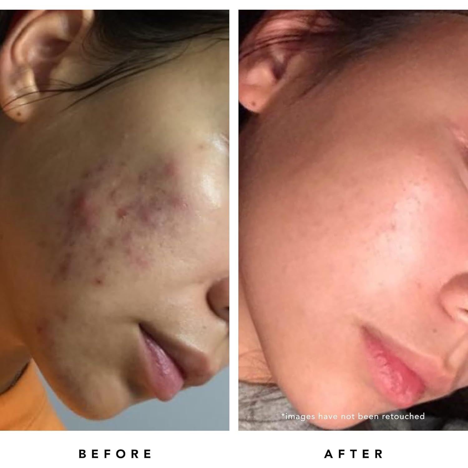 Máscara Refinadora de Poros Herbivore Blue Tansy 60 mL