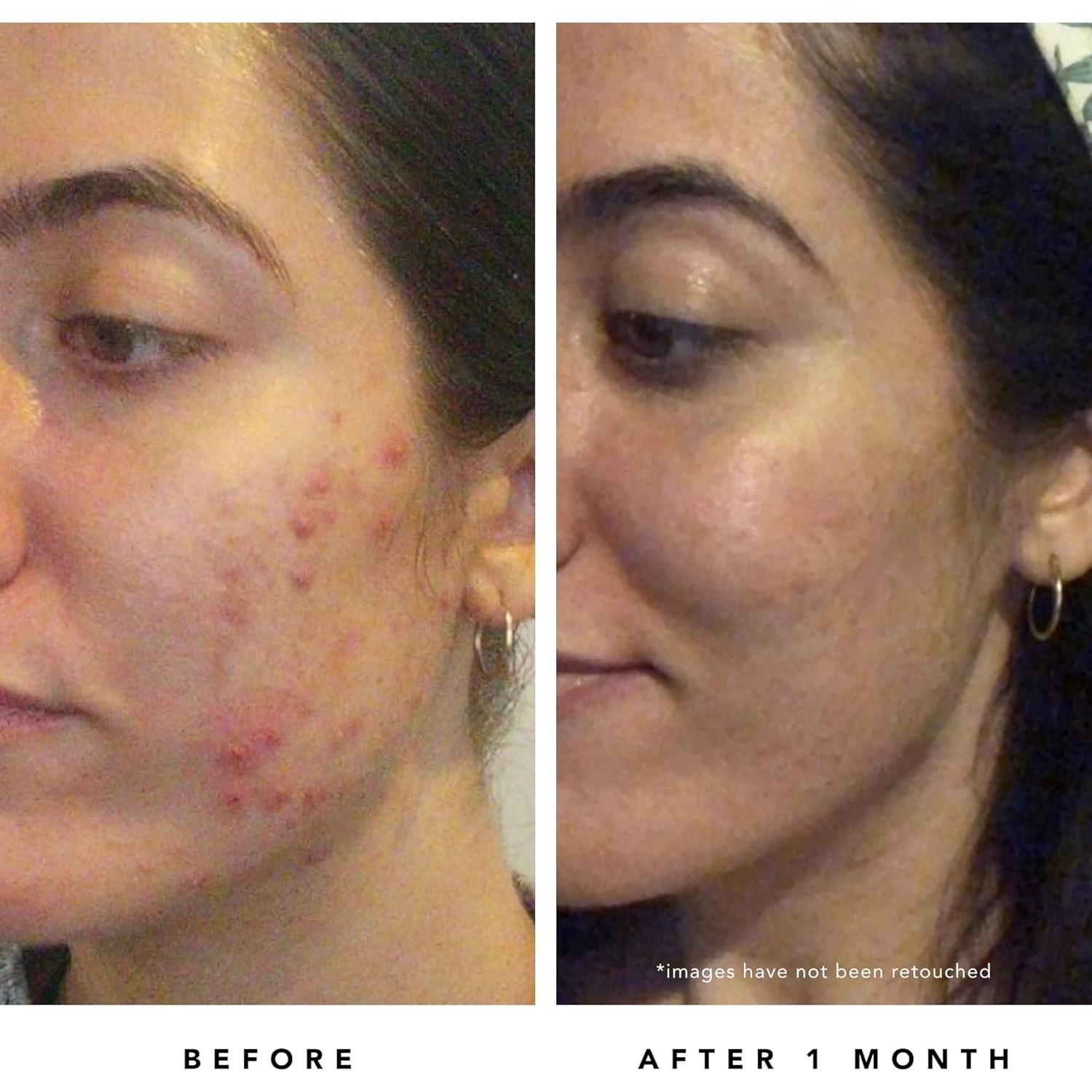 Máscara Refinadora de Poros Herbivore Blue Tansy 60 mL