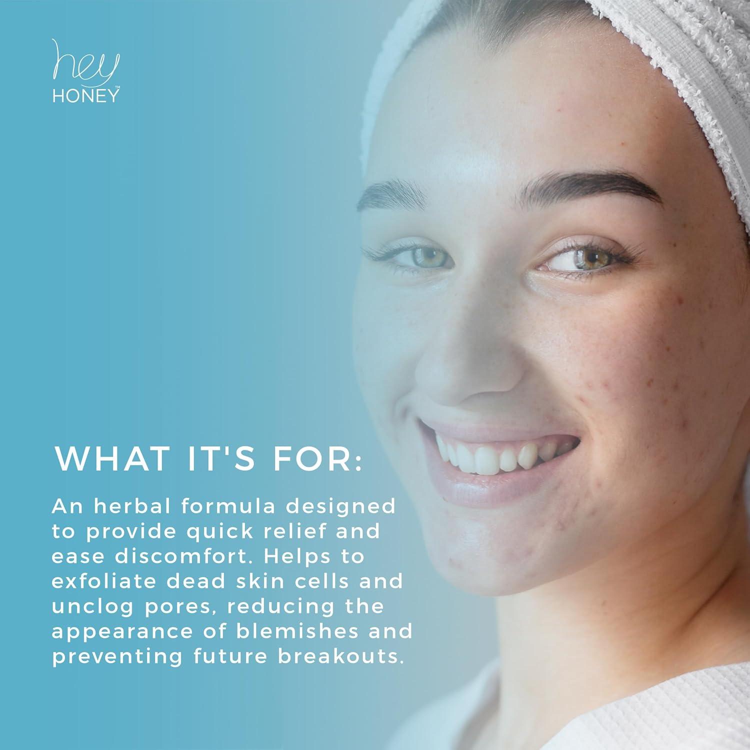 Crema Tratamiento Acné Hey Honey Be Clear 53.86 g