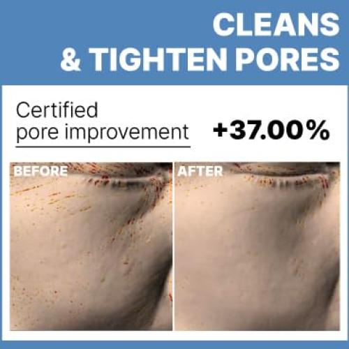 Paquete de 4 Máscaras Hidratantes Beureum Microbiome Colágeno