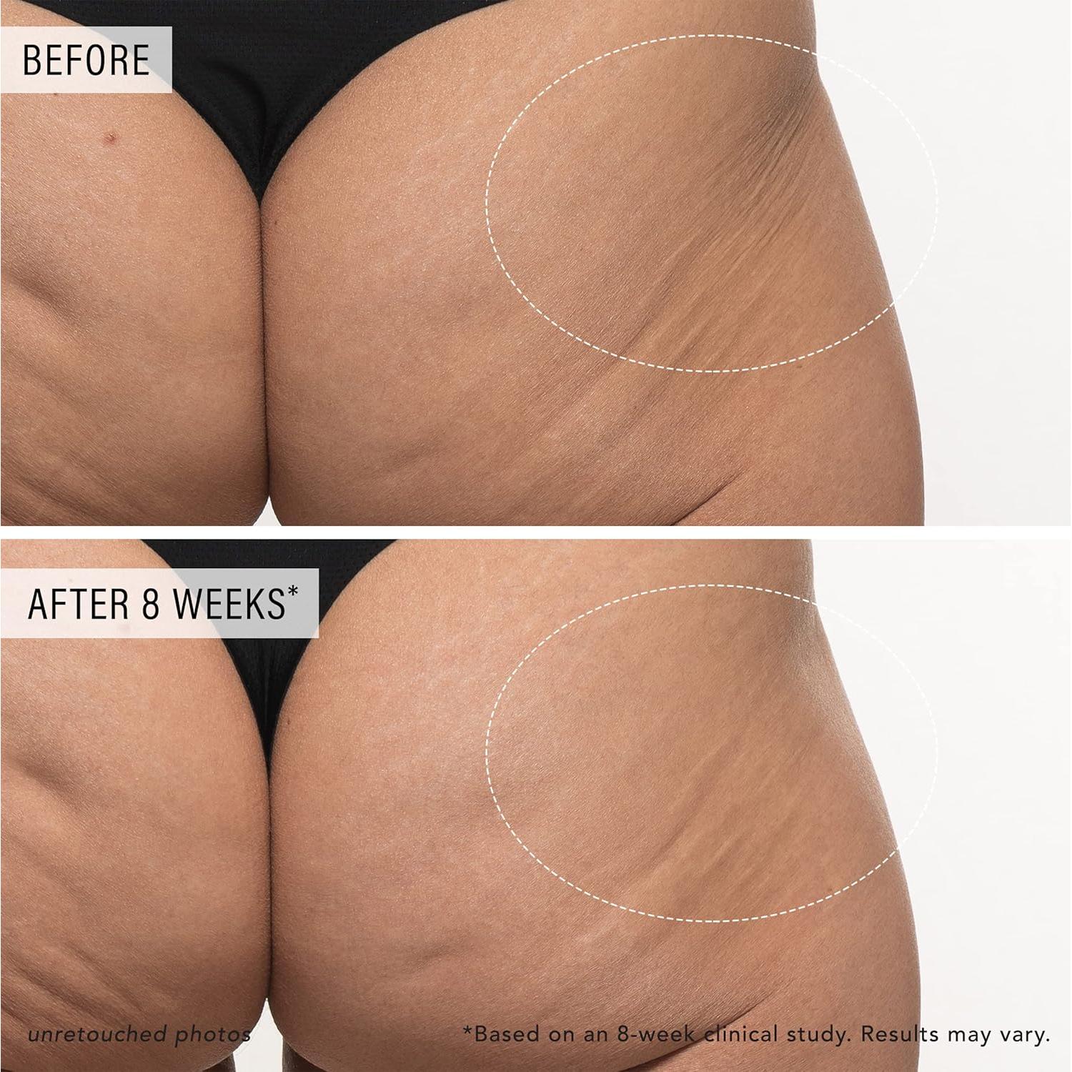 JLO BEAUTY Body Serum with AHAs & Peptides, Exfoliating Body Lotion for Radiant Smooth Skin, Hydrating Moisturizer to Support Elasticity, Even Tone & Visible Firming, Tighten + Tease, 4.06 Oz