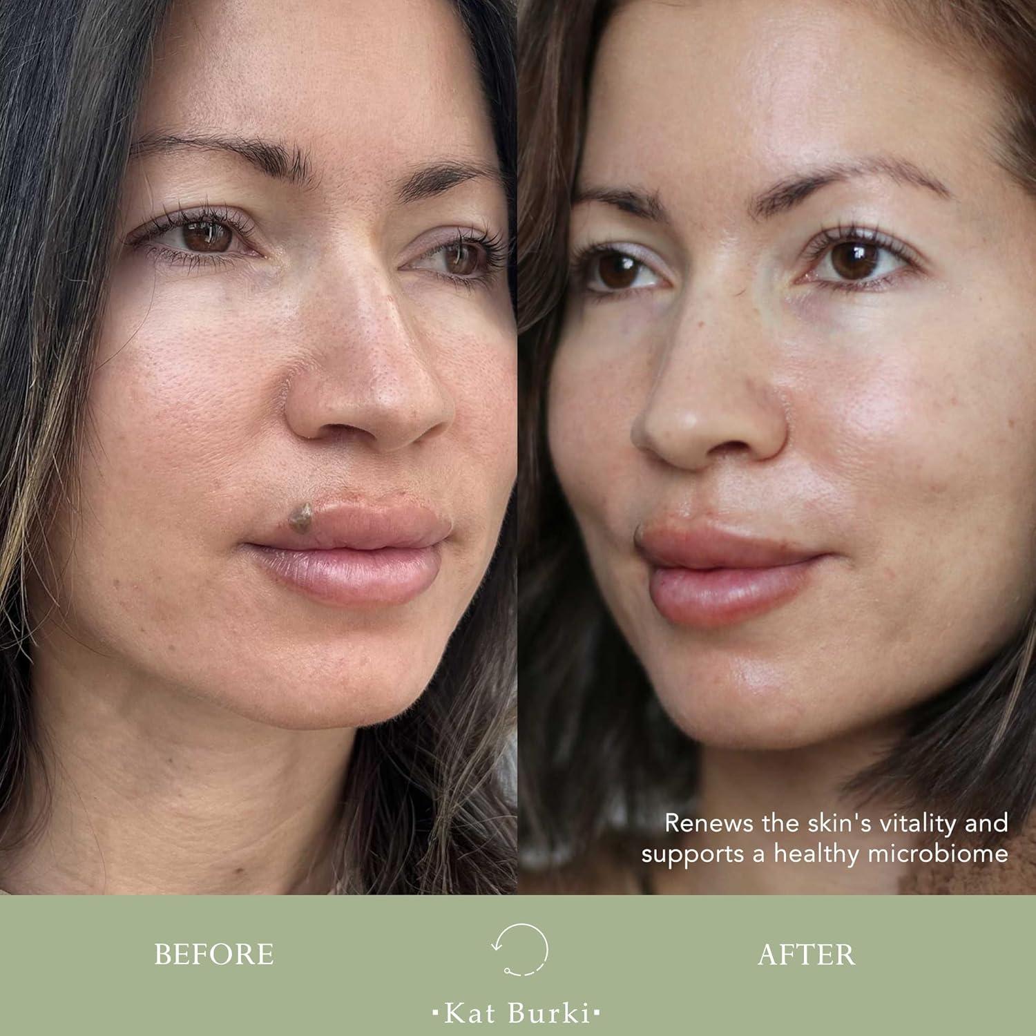 Suero Facial Enzimático Kat Burki pH+ 100 ml Equilibrante