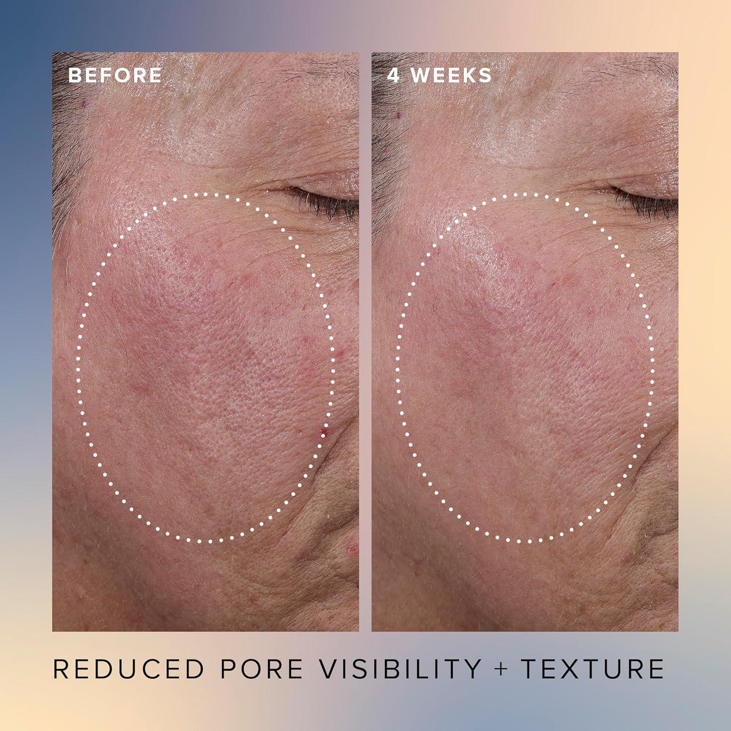 Suero Exfoliante Facial Farmacia Belleza 30ml AHA BHA Hidratante