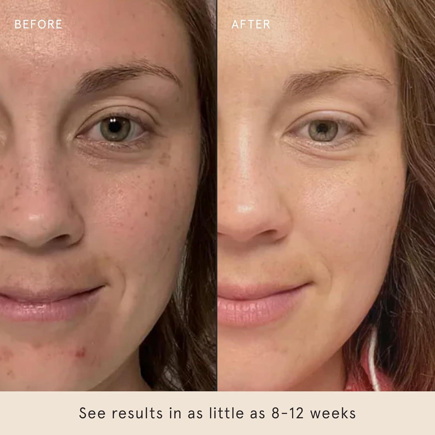 Suero Iluminador Barefaced 30 ml - Corrector de Manchas