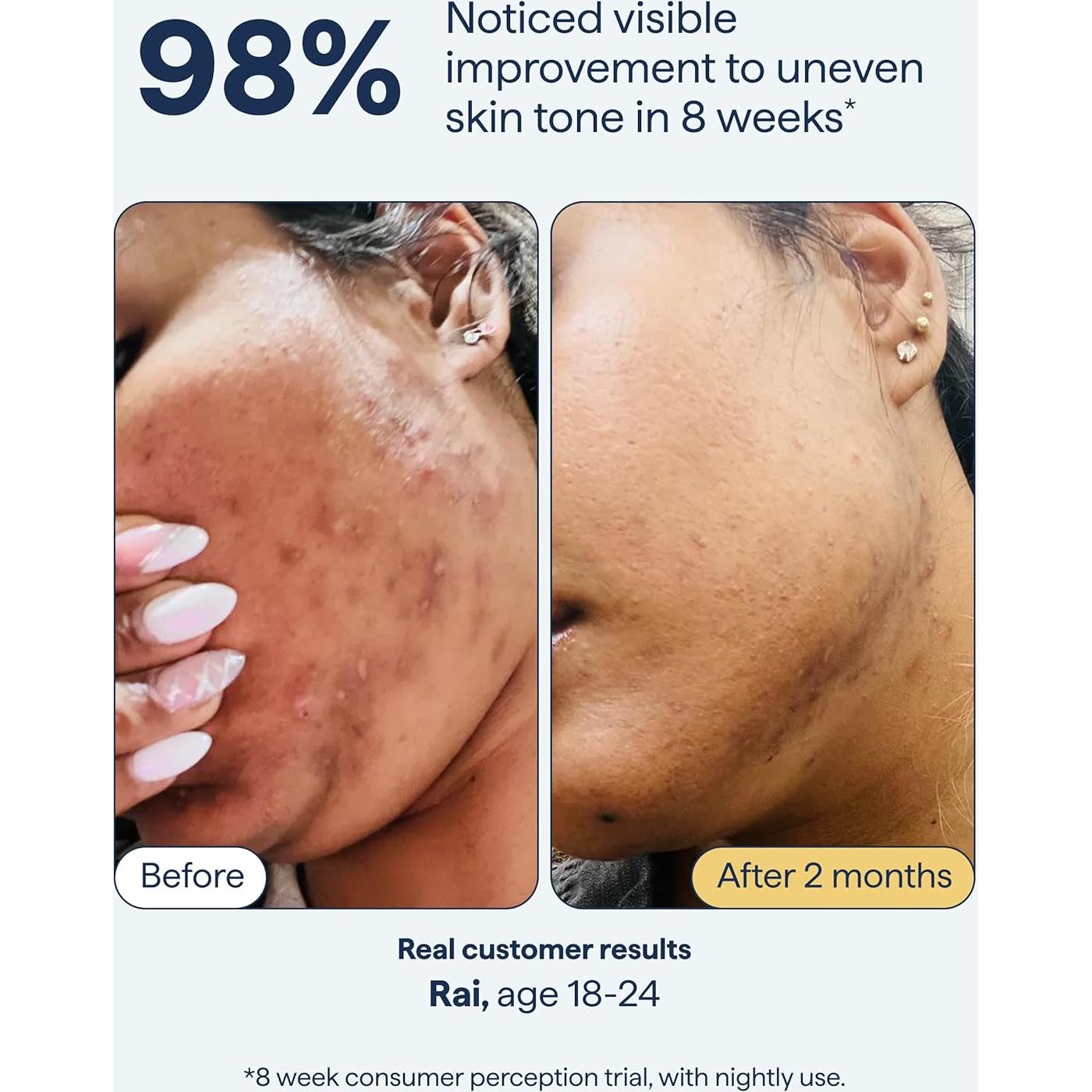 Tratamiento para Manchas Oscuras Dr. Shah - Retinol, Niacinamida