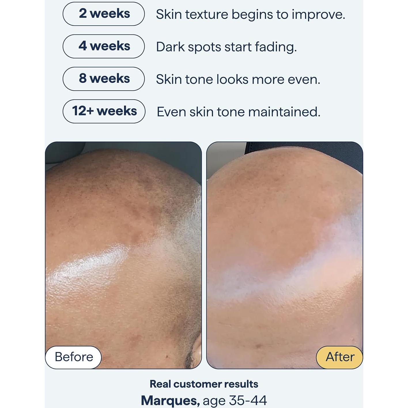 Tratamiento para Manchas Oscuras Dr. Shah - Retinol, Niacinamida