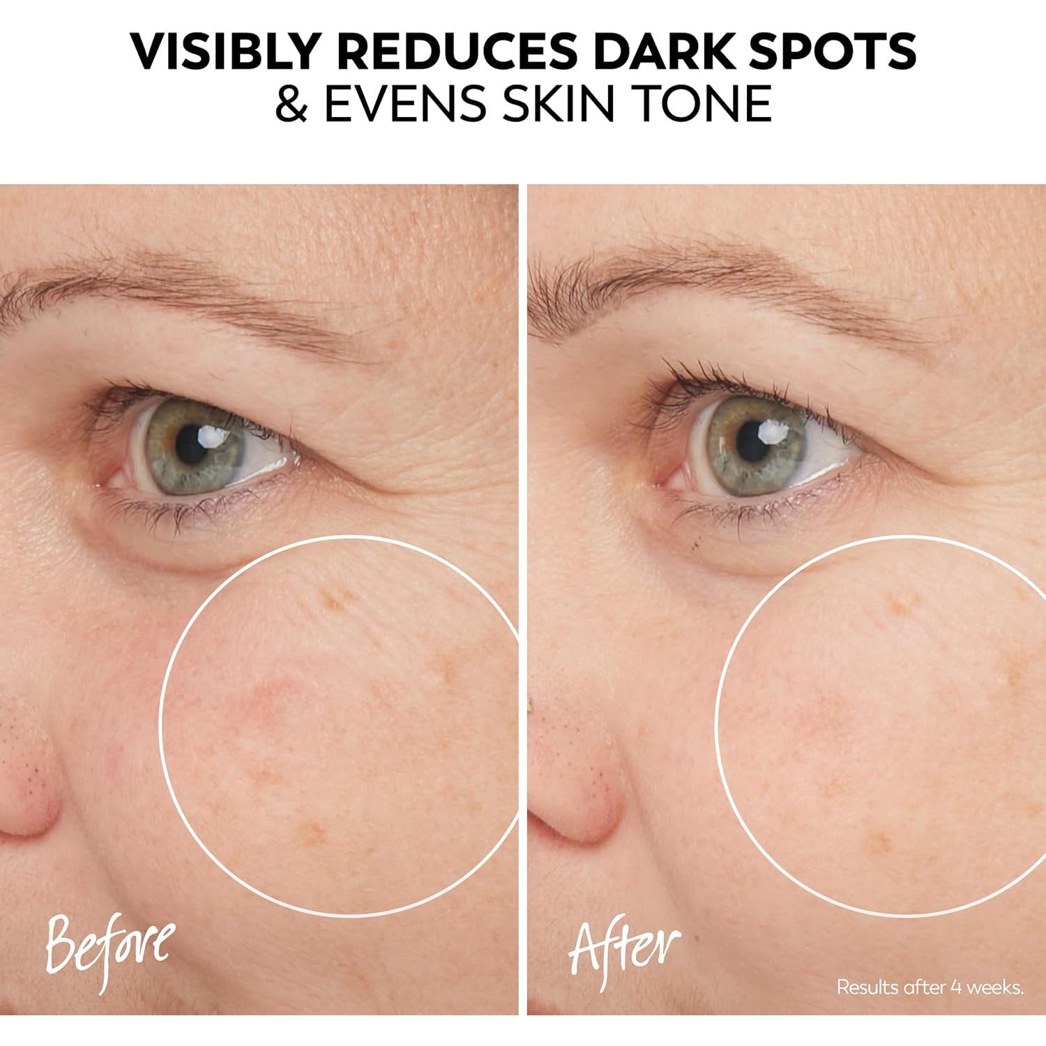 Olay Pro-X Serum Desvanecedor de Manchas 36.84 g - Tono Uniforme