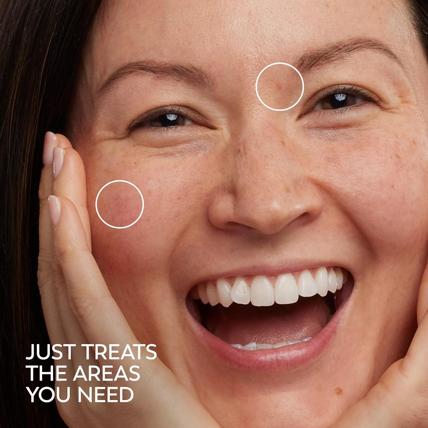 Olay Pro-X Serum Desvanecedor de Manchas 36.84 g - Tono Uniforme