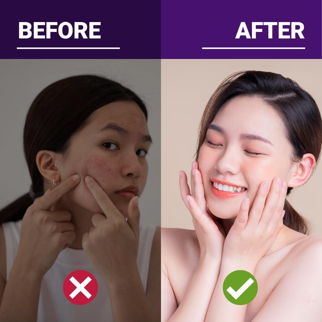 Suplemento Aceite de Borraja Orgánico 1200 mg Nuevas Raíces