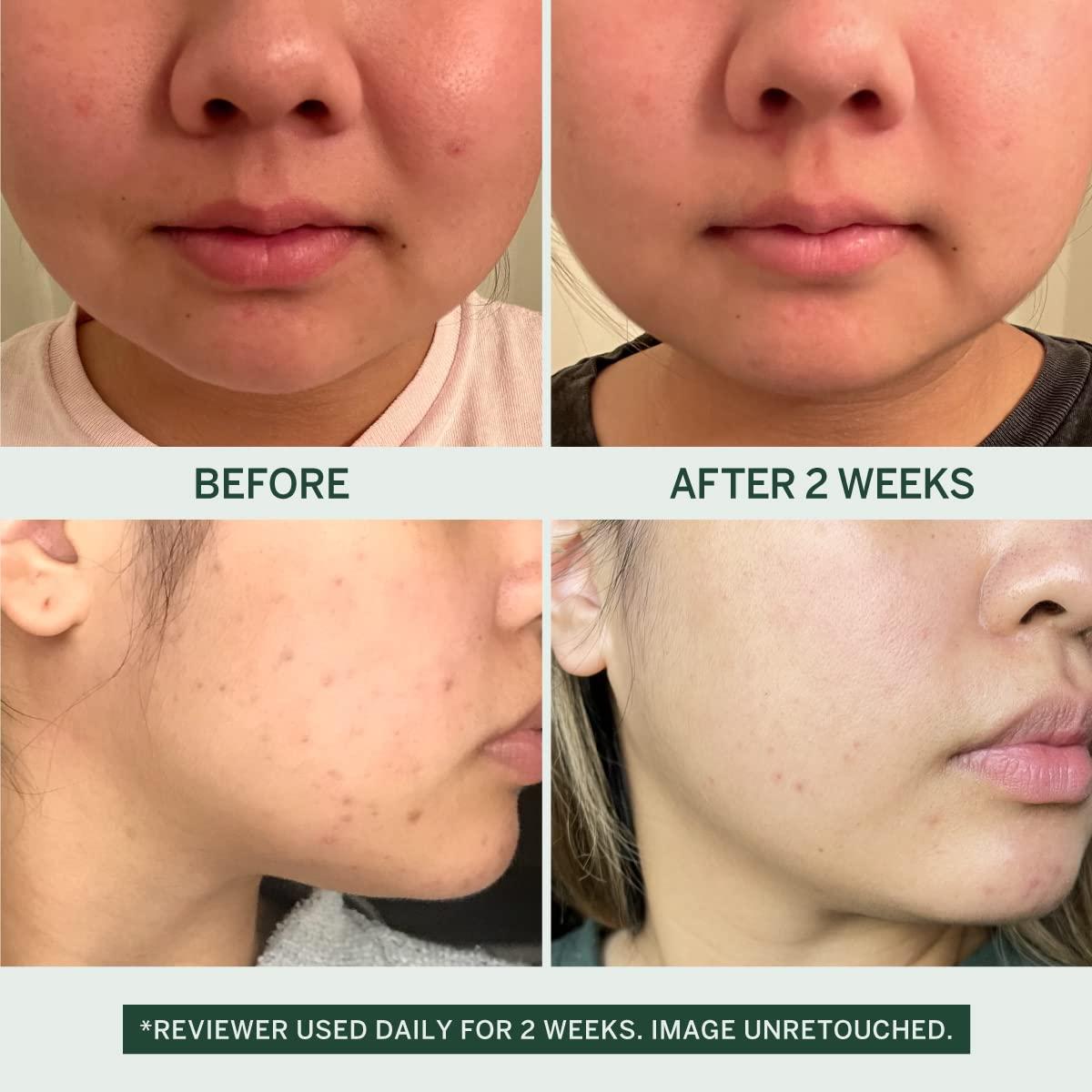 Gel Limpiador Facial Calmante FaceTory 30ml - Hidratante Exfoliante